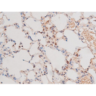 ADD1 / Adducin Alpha Antibody - 1:200 staining rat lung tissue by IHC-P. The tissue was formaldehyde fixed and a heat mediated antigen retrieval step in citrate buffer was performed. The tissue was then blocked and incubated with the antibody for 1.5 hours at 22°C. An HRP conjugated goat anti-rabbit antibody was used as the secondary.