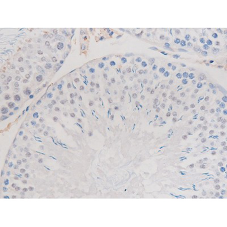 ADD1 / Adducin Alpha Antibody - 1:200 staining rat testis tissue by IHC-P. The tissue was formaldehyde fixed and a heat mediated antigen retrieval step in citrate buffer was performed. The tissue was then blocked and incubated with the antibody for 1.5 hours at 22°C. An HRP conjugated goat anti-rabbit antibody was used as the secondary.