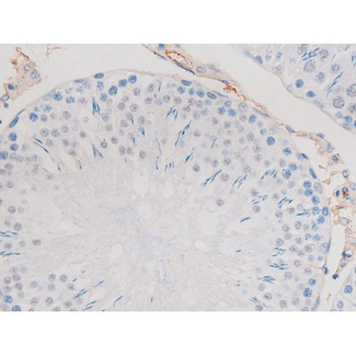 ADD1 / Adducin Alpha Antibody - 1:200 staining rat testis tissue by IHC-P. The tissue was formaldehyde fixed and a heat mediated antigen retrieval step in citrate buffer was performed. The tissue was then blocked and incubated with the antibody for 1.5 hours at 22°C. An HRP conjugated goat anti-rabbit antibody was used as the secondary.