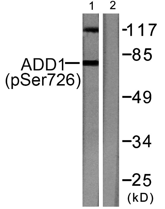 ADD1 / Adducin Alpha Antibody - Western blot analysis of extracts from Hela cells treated with Forskolin (40nM, 30mins), using ADD1 (phospho-Ser726) antibody.