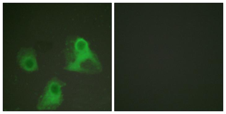 ADD1 / Adducin Alpha Antibody - P-peptide - + Immunofluorescence analysis of HeLa cells, using ADD1 (phospho-Ser726) antibody.