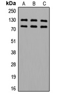 ADD1 / Adducin Alpha Antibody - Western blot analysis of Alpha-adducin (pS726/713) expression in HeLa (A); SP2/0 (B); PC12 (C) whole cell lysates.