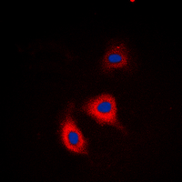 ADD1 / Adducin Alpha Antibody - Immunofluorescent analysis of Alpha-adducin (pS726/713) staining in HeLa cells. Formalin-fixed cells were permeabilized with 0.1% Triton X-100 in TBS for 5-10 minutes and blocked with 3% BSA-PBS for 30 minutes at room temperature. Cells were probed with the primary antibody in 3% BSA-PBS and incubated overnight at 4 C in a humidified chamber. Cells were washed with PBST and incubated with a DyLight 594-conjugated secondary antibody (red) in PBS at room temperature in the dark. DAPI was used to stain the cell nuclei (blue).