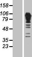 ADD1 / Adducin Alpha Protein - Western validation with an anti-DDK antibody * L: Control HEK293 lysate R: Over-expression lysate