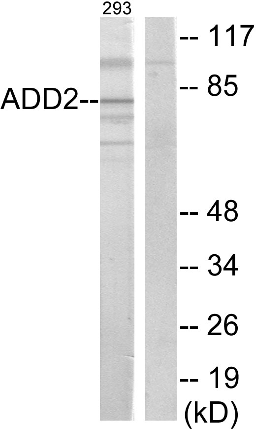 ADD2 Antibody - Western blot analysis of lysates from 293 cells, using ADD2 Antibody. The lane on the right is blocked with the synthesized peptide.