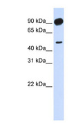ADD2 Antibody - ADD2 antibody Western blot of Transfected 293T cell lysate. This image was taken for the unconjugated form of this product. Other forms have not been tested.