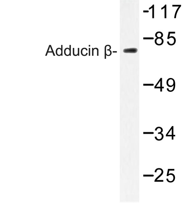 ADD2 Antibody - Western blot of Adducin (E497) pAb in extracts from 293 cells.