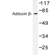 ADD2 Antibody - Western blot of Adducin (E497) pAb in extracts from 293 cells.