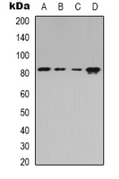 ADD2 Antibody - Western blot analysis of Beta-adducin expression in Jurkat (A); HEK293T (B); Raw264.7 (C); rat spleen (D) whole cell lysates.