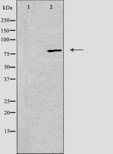 ADD2 Antibody - Western blot analysis of extracts of 293 cells using ADD2 antibody. The lane on the left is treated with the antigen-specific peptide.