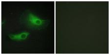 ADD2 Antibody - Peptide - + Immunofluorescence analysis of HeLa cells, using ADD2 antibody.