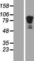 ADD2 Protein - Western validation with an anti-DDK antibody * L: Control HEK293 lysate R: Over-expression lysate