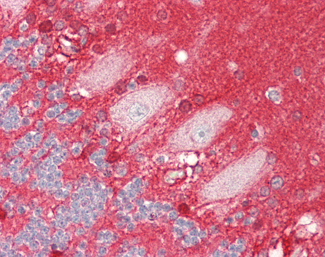 ADD3 Antibody - Human Brain, Cerebellum: Formalin-Fixed, Paraffin-Embedded (FFPE).  This image was taken for the unconjugated form of this product. Other forms have not been tested.