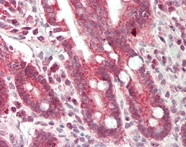 ADD3 Antibody - Human Small Intestine: Formalin-Fixed, Paraffin-Embedded (FFPE).  This image was taken for the unconjugated form of this product. Other forms have not been tested.