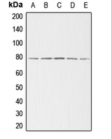 ADD3 Antibody - Western blot analysis of Gamma-adducin expression in HeLa (A); NIH3T3 (B); H9C2 (C); A375 (D); K562 (E) whole cell lysates.