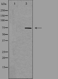ADD3 Antibody - Western blot analysis of extracts of HepG2 cells using ADD3 antibody. The lane on the left is treated with the antigen-specific peptide.