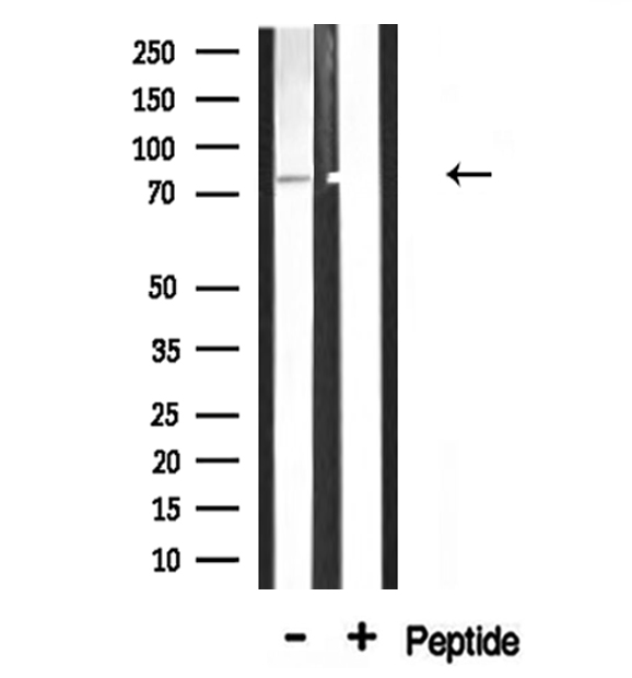ADD3 Antibody - Western blot analysis of ADD3 expression in rat muscle lysate