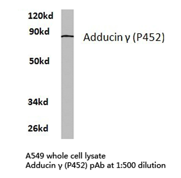 ADD3 Antibody - Western blot of Adducin (P452) pAb in extracts from A549 cells.