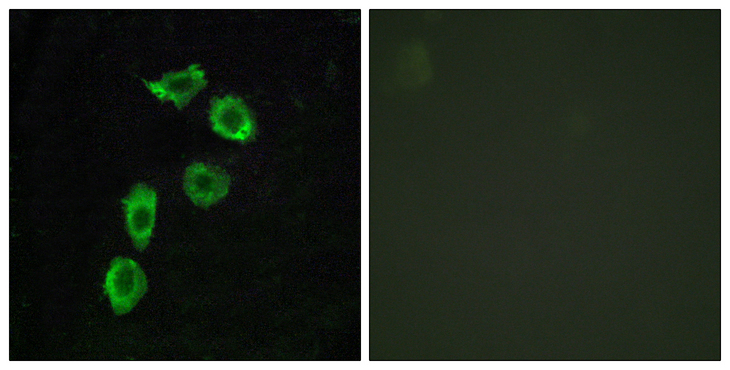 ADGRA1 / GPR123 Antibody - Immunofluorescence analysis of HUVEC cells, using GPR123 Antibody. The picture on the right is blocked with the synthesized peptide.