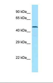 ADGRA1 / GPR123 Antibody - Western blot of Human PANC1. GPR123 antibody dilution 1.0 ug/ml.  This image was taken for the unconjugated form of this product. Other forms have not been tested.