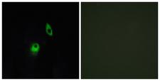 ADGRA2 / GPR124 Antibody - Immunofluorescence analysis of HeLa cells, using GPR124 Antibody. The picture on the right is blocked with the synthesized peptide.
