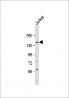 ADGRA2 / GPR124 Antibody - Anti-GPR124 Antibody (C-Term) at 1:2000 dilution + Jurkat whole cell lysate Lysates/proteins at 20 ug per lane. Secondary Goat Anti-Rabbit IgG, (H+L), Peroxidase conjugated at 1:10000 dilution. Predicted band size: 143 kDa. Blocking/Dilution buffer: 5% NFDM/TBST.