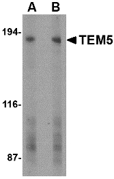 ADGRA2 / GPR124 Antibody - Western blot of TEM5 in human bladder tissue lysate with TEM5 antibody at (A) 2 and (B) 4 ug/ml. Below: Immunohistochemistry of TEM5 in human bladder tissue with TEM5 antibody at 5 ug/ml.