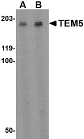 ADGRA2 / GPR124 Antibody - Western blot of TEM5 in rat kidney tissue lysate with TEM5 antibody at (A) 2 ug/ml and (B) 4 ug/ml. Below: Immunohistochemistry of TEM5 in human bladder tissue with TEM5 antibody at 5 ug/ml.