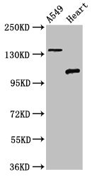 ADGRA2 / GPR124 Antibody - Positive Western Blot detected in A549 whole cell lysate, Rat heart tissue. All lanes: ADGRA2 antibody at 3 µg/ml Secondary Goat polyclonal to rabbit IgG at 1/50000 dilution. Predicted band size: 143, 120, 20 KDa. Observed band size: 143, 120 KDa