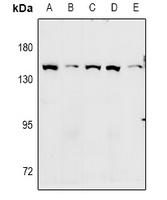 ADGRA2 / GPR124 Antibody - Western blot analysis of GPR124 expression in CT26 (A), PMVEC (B), MEF (C), A549 (D), LOVO (E) whole cell lysates.