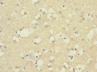 ADGRB1 / BAI1 Antibody - Immunohistochemistry of paraffin-embedded human brain tissue at dilution 1:100