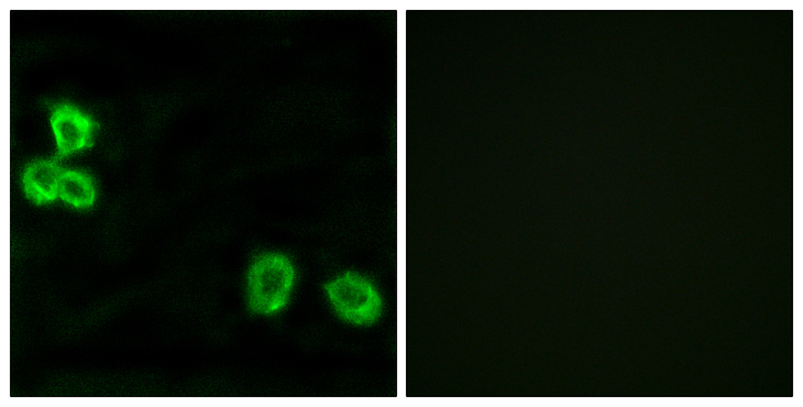 ADGRB1 / BAI1 Antibody - Immunofluorescence analysis of MCF7 cells, using BAI1 Antibody. The picture on the right is blocked with the synthesized peptide.