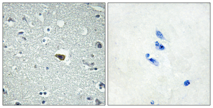 ADGRB1 / BAI1 Antibody - Immunohistochemistry analysis of paraffin-embedded human brain tissue, using BAI1 Antibody. The picture on the right is blocked with the synthesized peptide.