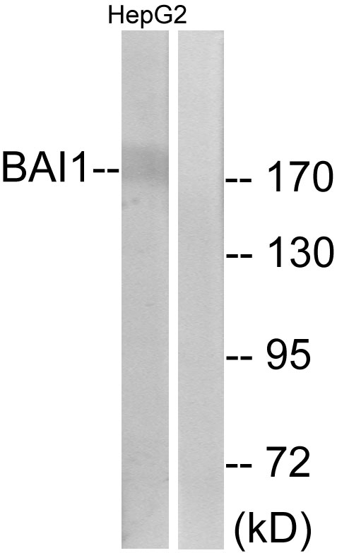 ADGRB1 / BAI1 Antibody - Western blot analysis of lysates from HepG2 cells, using BAI1 Antibody. The lane on the right is blocked with the synthesized peptide.