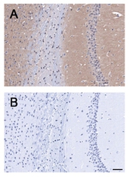 ADGRB1 / BAI1 Antibody - Immunohistochemistry-Paraffin: BAI1 Antibody - A. Staining of mouse brain. B. Blocking of staining using control peptide.  This image was taken for the unconjugated form of this product. Other forms have not been tested.