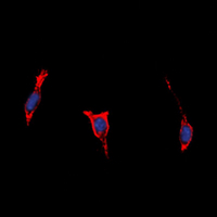 ADGRB1 / BAI1 Antibody - Immunofluorescent analysis of BAI1 staining in HepG2 cells. Formalin-fixed cells were permeabilized with 0.1% Triton X-100 in TBS for 5-10 minutes and blocked with 3% BSA-PBS for 30 minutes at room temperature. Cells were probed with the primary antibody in 3% BSA-PBS and incubated overnight at 4 ??C in a humidified chamber. Cells were washed with PBST and incubated with a DyLight 594-conjugated secondary antibody (red) in PBS at room temperature in the dark. DAPI was used to stain the cell nuclei (blue).