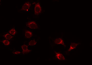 ADGRB1 / BAI1 Antibody - Staining HeLa cells by IF/ICC. The samples were fixed with PFA and permeabilized in 0.1% Triton X-100, then blocked in 10% serum for 45 min at 25°C. The primary antibody was diluted at 1:200 and incubated with the sample for 1 hour at 37°C. An Alexa Fluor 594 conjugated goat anti-rabbit IgG (H+L) Ab, diluted at 1/600, was used as the secondary antibody.