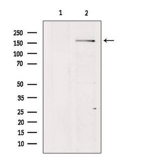 ADGRB1 / BAI1 Antibody - Western blot analysis of extracts of mouse Myeloma cells using BAI1 antibody. Lane 1 was treated with the blocking peptide.