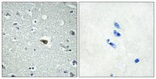 ADGRB1 / BAI1 Antibody - Peptide - + Immunohistochemistry analysis of paraffin-embedded human brain tissue using BAI1 antibody.