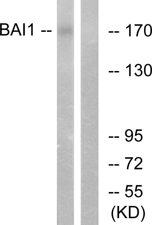 ADGRB1 / BAI1 Antibody - Western blot analysis of extracts from Jurkat cells, using BAI1 antibody.