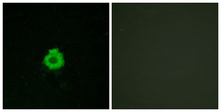 ADGRB2 / BAI2 Antibody - Immunofluorescence analysis of HUVEC cells, using BAI2 Antibody. The picture on the right is blocked with the synthesized peptide.