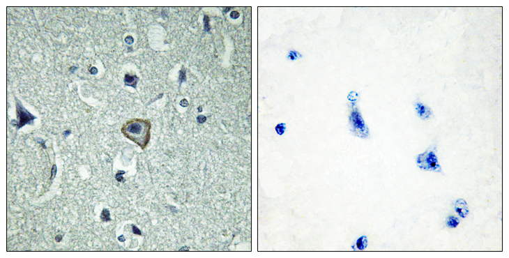 ADGRB2 / BAI2 Antibody - Immunohistochemistry analysis of paraffin-embedded human brain tissue, using BAI2 Antibody. The picture on the right is blocked with the synthesized peptide.