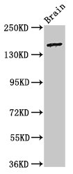 ADGRB2 / BAI2 Antibody - Positive Western Blot detected in Rat brain tissue. All lanes: ADGRB2 antibody at 3.2 µg/ml Secondary Goat polyclonal to rabbit IgG at 1/50000 dilution. Predicted band size: 173, 172, 170 KDa. Observed band size: 173 KDa