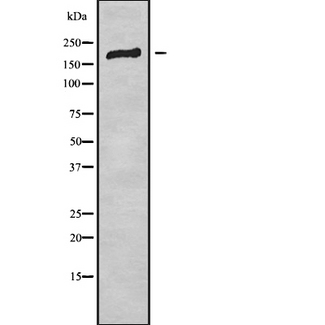 ADGRB2 / BAI2 Antibody - Western blot analysis of BAI2 using HepG2 whole cells lysates