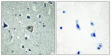 ADGRB2 / BAI2 Antibody - Peptide - + Immunohistochemistry analysis of paraffin-embedded human brain tissue using BAI2 antibody.