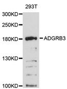 ADGRB3 / BAI3 Antibody - Western blot analysis of extracts of 293T cells, using ADGRB3 antibody at 1:3000 dilution. The secondary antibody used was an HRP Goat Anti-Rabbit IgG (H+L) at 1:10000 dilution. Lysates were loaded 25ug per lane and 3% nonfat dry milk in TBST was used for blocking. An ECL Kit was used for detection and the exposure time was 90s.
