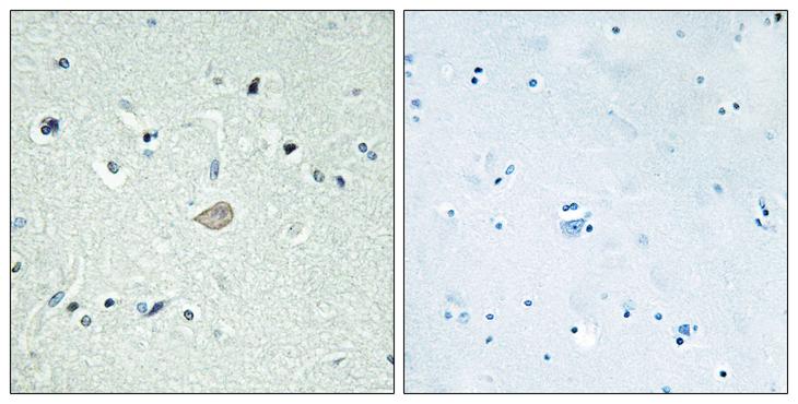 ADGRB3 / BAI3 Antibody - Peptide - + Immunohistochemistry analysis of paraffin-embedded human brain tissue using BAI3 antibody.