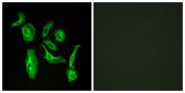 ADGRD1 / GPR133 Antibody - Immunofluorescence analysis of HeLa cells, using GPR133 Antibody. The picture on the right is blocked with the synthesized peptide.