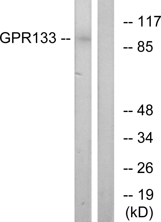 ADGRD1 / GPR133 Antibody - Western blot analysis of lysates from COS7 cells, using GPR133 Antibody. The lane on the right is blocked with the synthesized peptide.