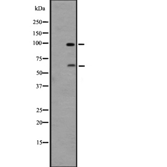 ADGRD1 / GPR133 Antibody - Western blot analysis of GPR133 expression in 293 cells line lysates. The lane on the left is treated with the antigen-specific peptide.